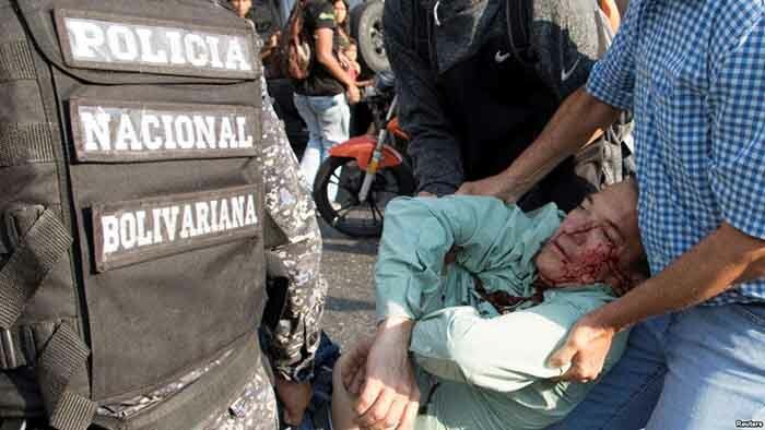 Venezuela: l'opposant Falcon dénonce une agression contre un député